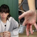 maos-e-bracos-cheios-de-sangue:-nina-baiocchi-e-assaltada,-fica-ferida-e-relata-o-crime