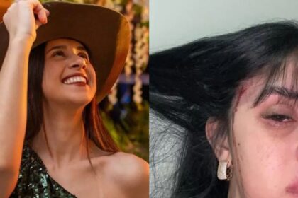 o-que-aconteceu-com-a-cantora-debora-amorim?-relembre-o-ataque-brutal-a-sertaneja-em-sc