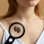 sc-e-o-estado-do-sul-com-maior-risco-para-este-tipo-de-cancer:-veja-como-se-prevenir