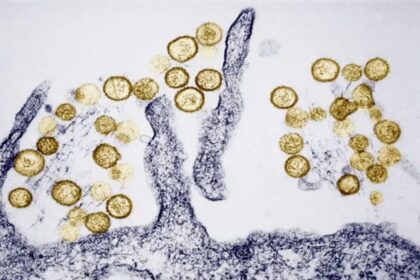 doenca-rara-e-letal:-o-que-e-o-hantavirus-que-matou-3-em-cruzeiro-e-acendeu-alerta