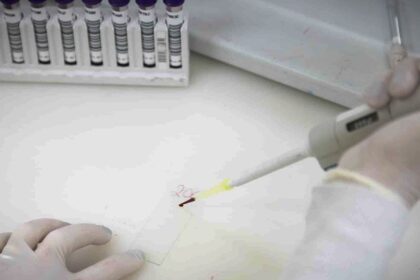 paciente-em-sp-com-suspeita-de-ebola-testa-positivo-para-meningite