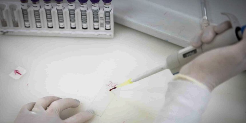 paciente-em-sp-com-suspeita-de-ebola-testa-positivo-para-meningite