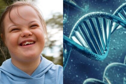 cientistas-eliminam-cromossomo-extra-da-sindrome-de-down-em-celulas-humanas-pela-1a-vez