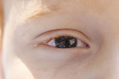 baixa-visao-na-infancia:-especialista-alerta-para-diagnostico-precoce