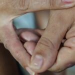 dermatite-atopica-impacta-pele,-sono-e-autoestima:-saiba-como-tratar